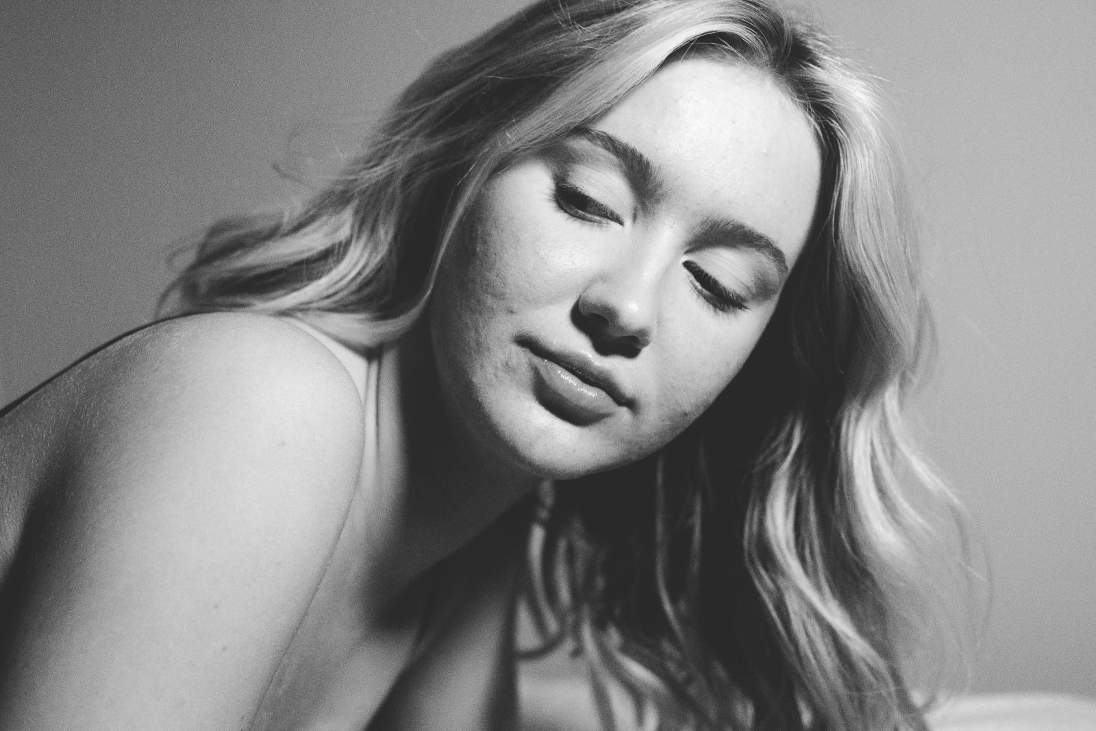 Gula menimbulkan jerawat (sumber : unsplash)